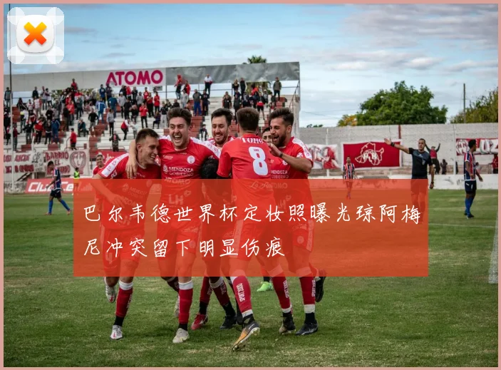 巴尔韦德世界杯定妆照曝光琼阿梅尼冲突留下明显伤痕